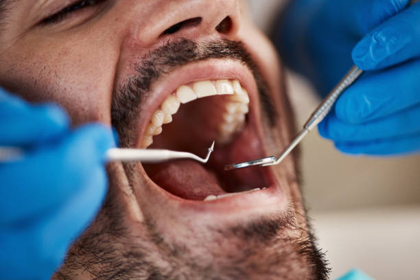 Best Emergency Dental Services for Seniors in Mayo, SC