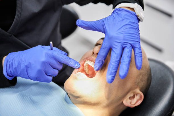 Best Emergency Dentist for Knocked-Out Tooth in Mayo, SC